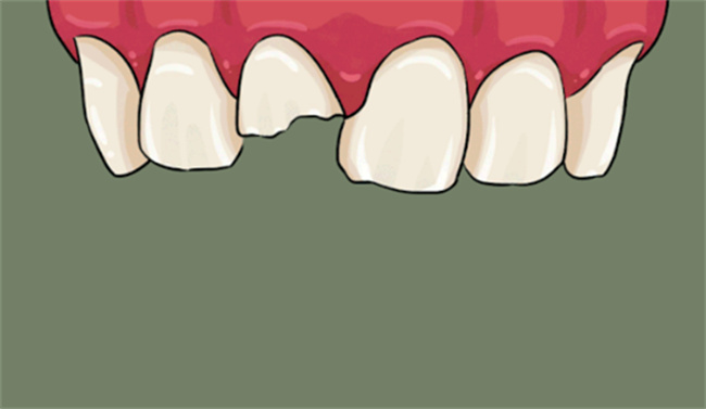 Picture14