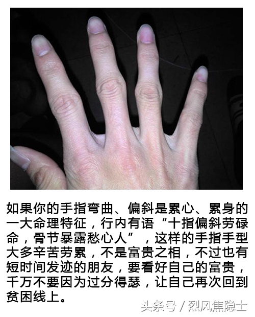 手指粗的女人風(fēng)水不好嗎？多是做苦力？