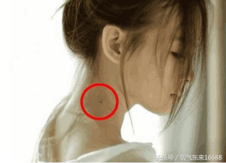 痣相圖解：女人脖子上有痣圖解